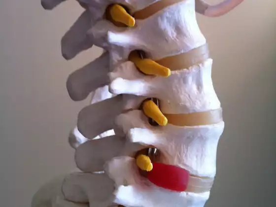 Back Pain Therapy